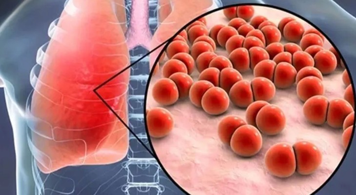 কুলাউড়ায় রক্তের নমুনা নেওয়ার সময় প্রাণ হারালো নিউমোনিয়ায় আক্রান্ত শিশু